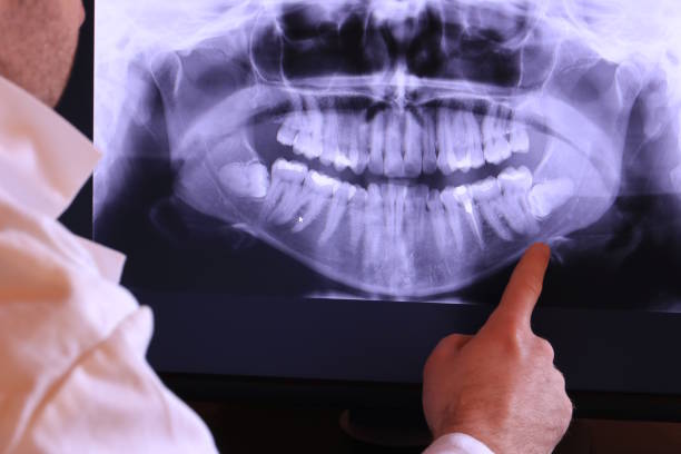 Best Emergency Treatment for Dental Infections or Abscesses in El Paso De Robles, CA